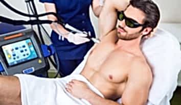 Лазерная эпиляция для мужчин 7